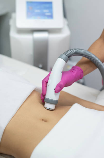 Uplift Body radiofrecuencia corporal